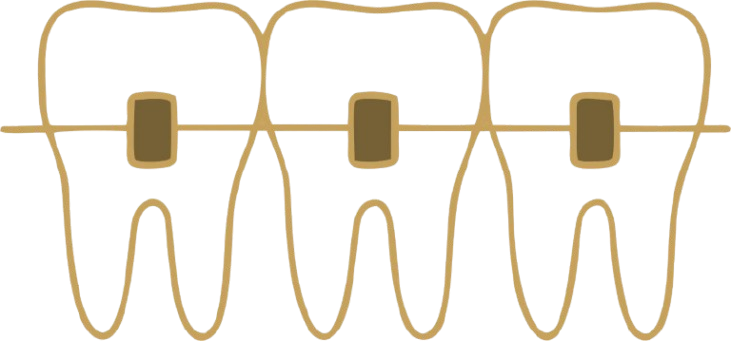 Apparecchio dentale, simbolo del servizio di Ortodonzia a Passo Corese
